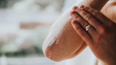 जाडोमा छालामा देखिने समस्याबाट कसरी जोगिन सकिन्छ?