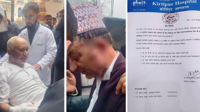 उपप्रधानमन्त्री पौडेल र नगर प्रमुख आचार्यलाई उच्च निगरानीमा उपचार गर्नुपर्छ : कीर्तिपुर अस्पताल